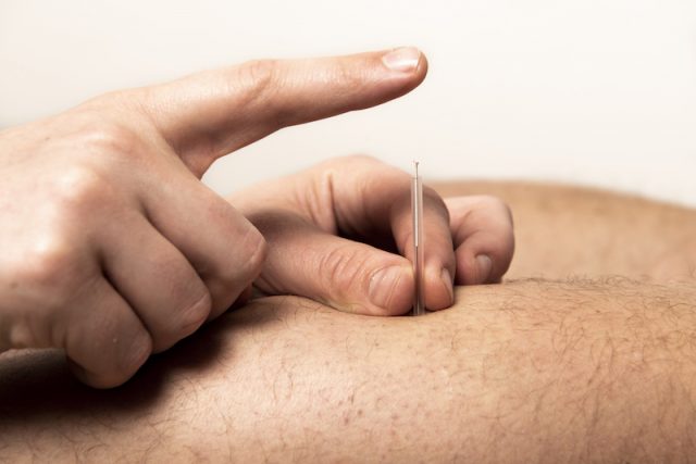 illustrasjon av nål som blir satt inn i huden for behandling
