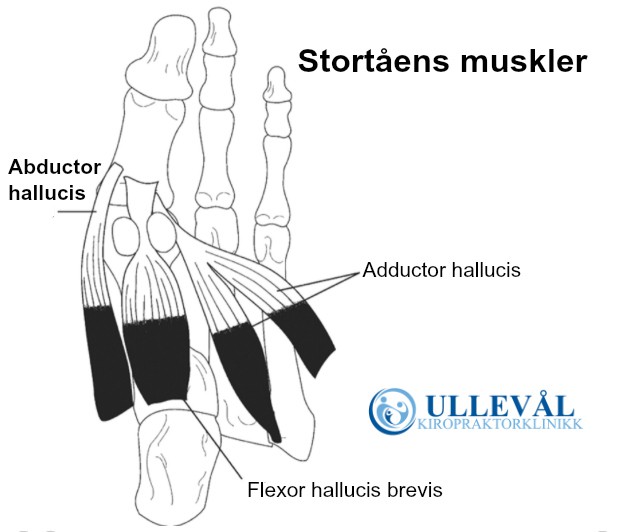 hallux valgus fotmuskler