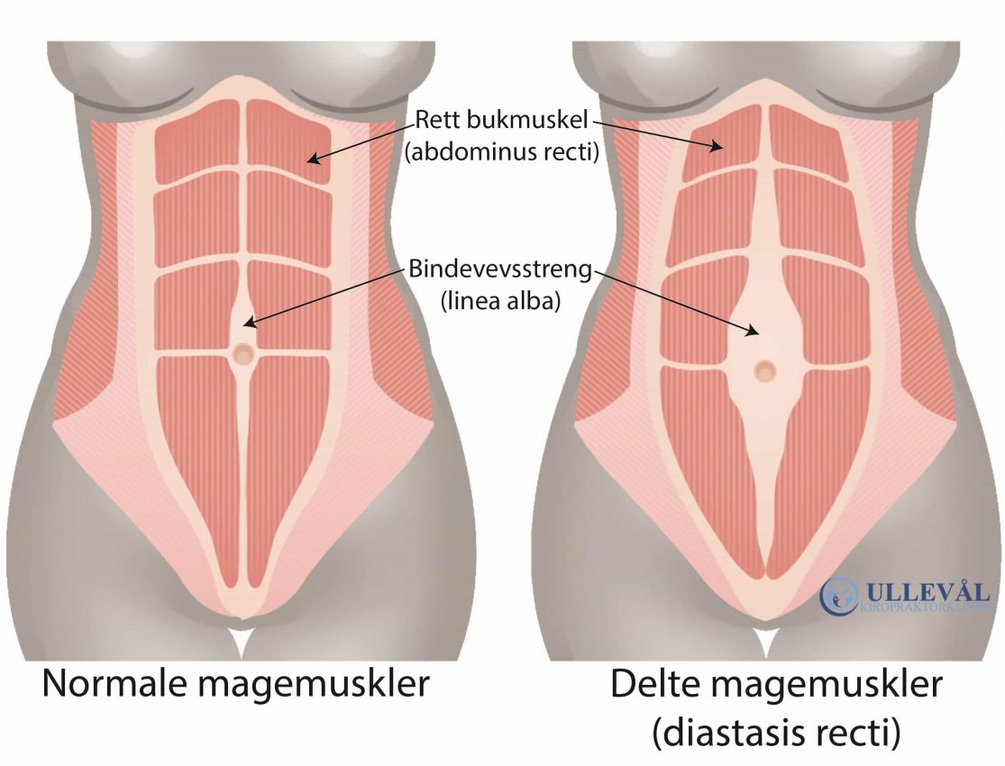 delte magemuskler illustrasjon