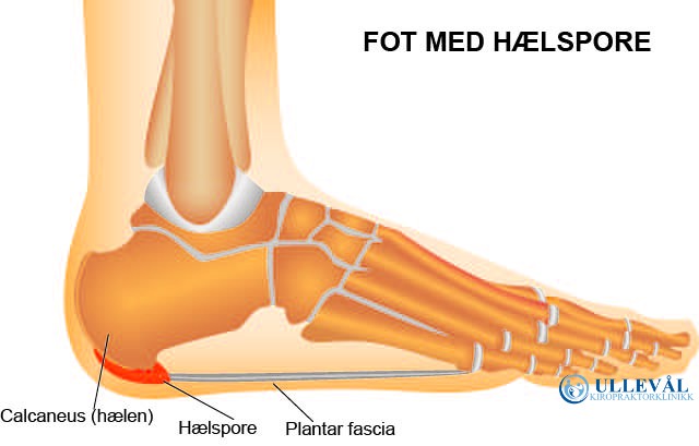 fot med hælspore