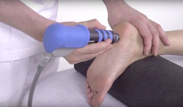 trykkbølgebehandling for plantar fascitt