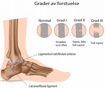 Image: <thrive_headline click tho-post-8085 tho-test-194>Supre matvarer og næringsstoffer som hjelper tilheling etter muskelskader</thrive_headline>