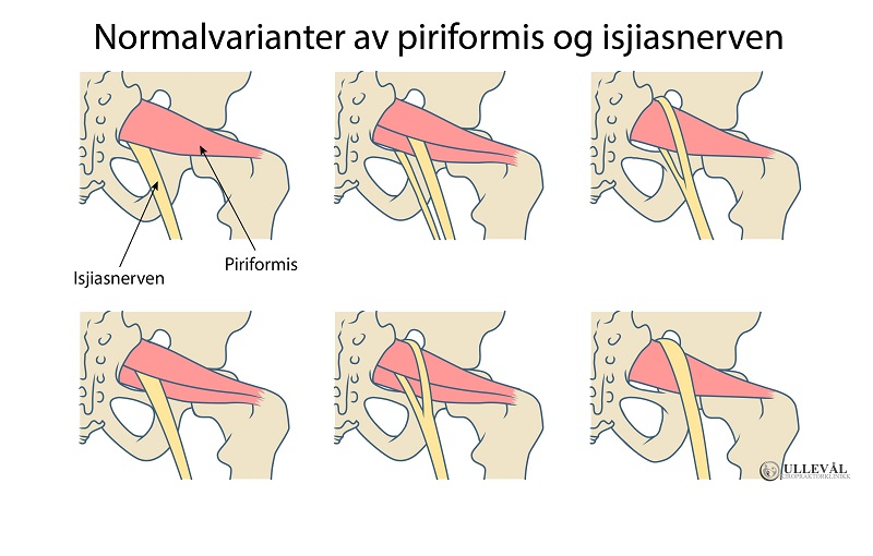 piriformis varianter