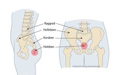 Image: Disse 7 muskelknutene kan føre til halebeinsmerter