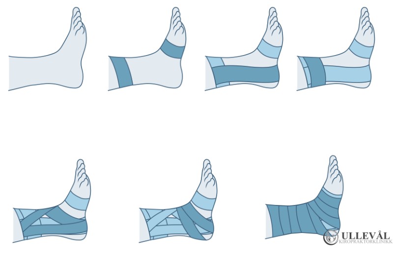 visuell visning av taping for stabilisering av ankel