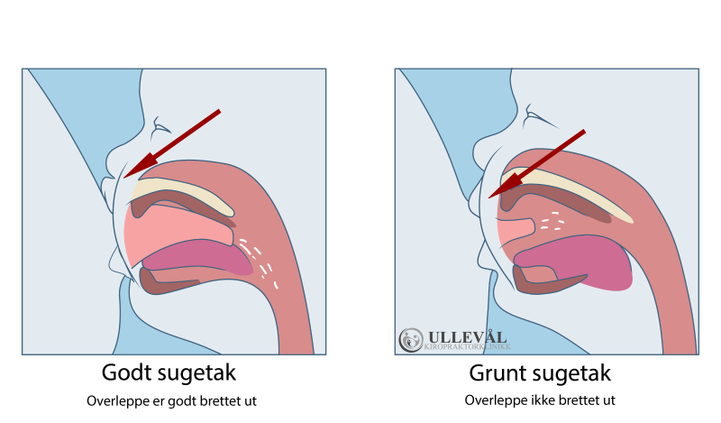 baby som ammer med godt sugetag og baby med grunt sugetak 
