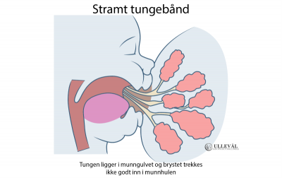 Image: <thrive_headline click tho-post-5290 tho-test-195>Stramt tungebånd hos baby</thrive_headline>