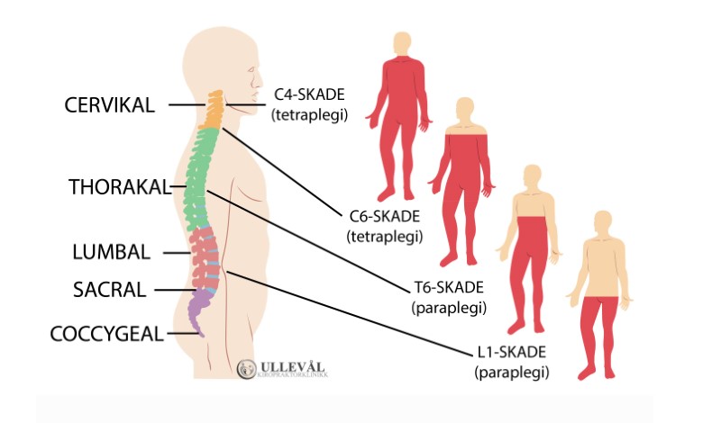 symptomer ved ryggmargskade