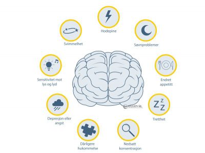 Image: Hvorfor får noen sensymptomer etter hjernerystelse?